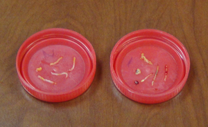 Δείγματα Βιοψίας Δείγματα Βιοψίας